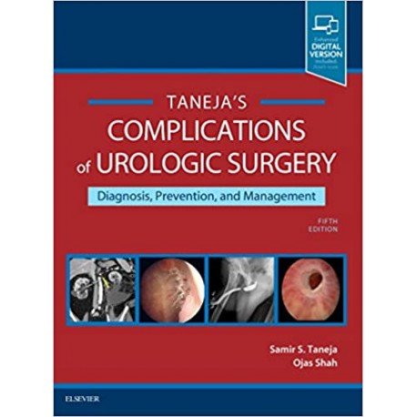 Complications of Urologic Surgery