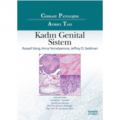 Cerrahi Patolojide Ayırıcı Tanı Kadın Genital Sistem