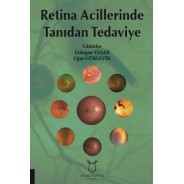 Retina Acillerinde Tanıdan Tedaviye