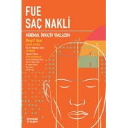 Fue Saç Nakli