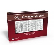 Olgu Örnekleriyle EEG