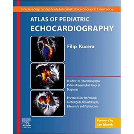 Atlas of Pediatric Echocardiography