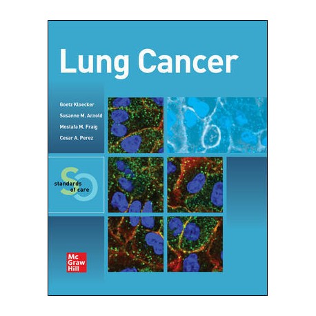 Lung Cancer: Standards Of Care