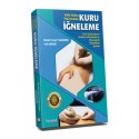 Tetik Nokta Tedavisinde Kuru İğneleme