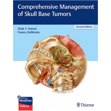 Comprehensive Management of Skull Base Tumors