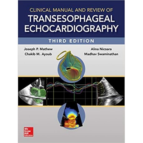 Clinical Manual and Review of Transesophageal Echocardiography 3rd Edition