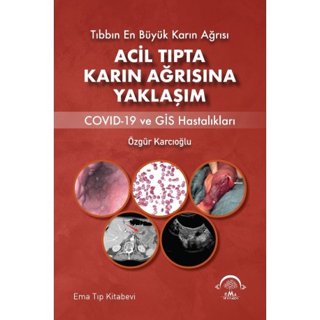 Acil Tıpta Karın Ağrısına Yaklaşım