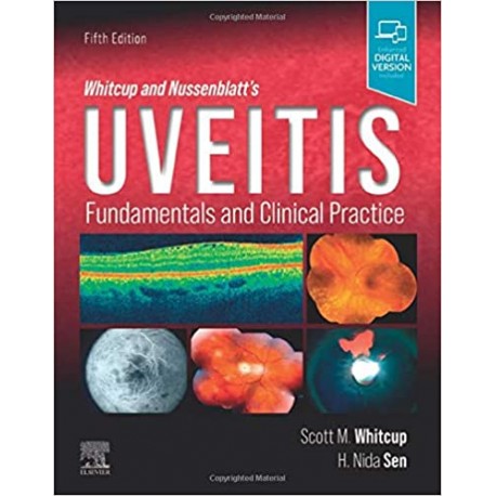 Whitcup and Nussenblatt's Uveitis, 5th Edition