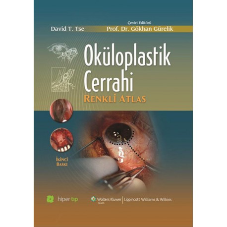 Oküloplastik Cerrahi