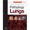 Pathology of the Lungs