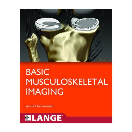 Basic Musculoskeletal Imaging