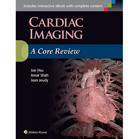 Cardiac Imaging: A Core Review