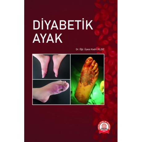 Diyabetik Ayak