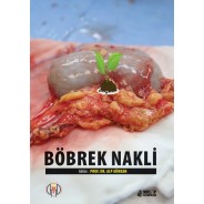 Böbrek Nakli