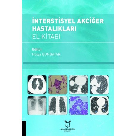 İnterstisyel Akciğer Hastalıkları El Kitabı