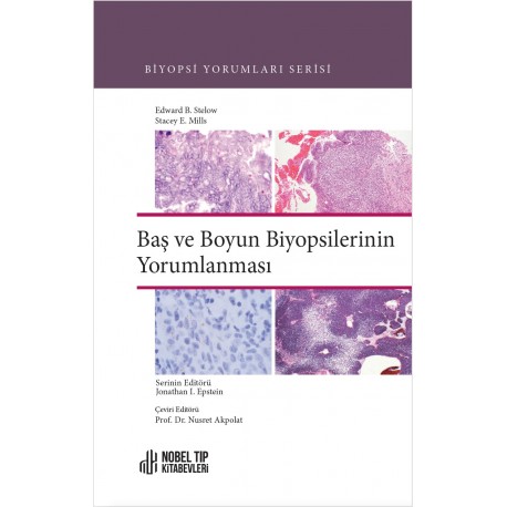 Baş ve Boyun Biyopsilerinin Yorumlanması