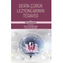 Derin Çürük Lezyonlarının Tedavisi