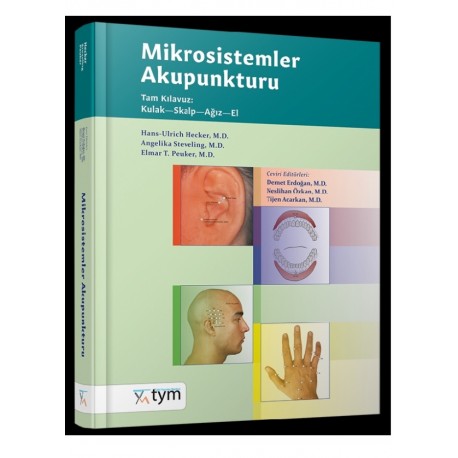 Mikrosistemler Akupunkturu