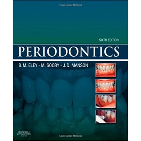 Periodontics 6th Edition