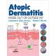 Atopic Dermatitis: Inside Out or Outside In