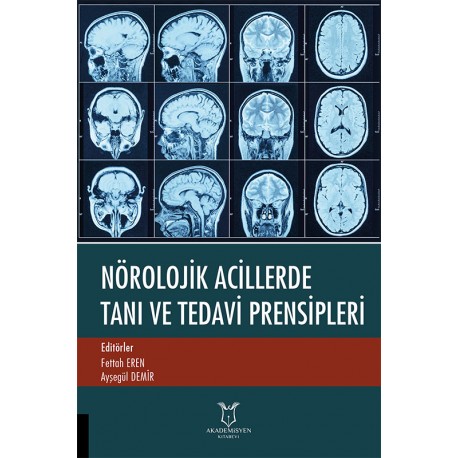 Nörolojik Acillerde Tanı ve Tedavi Prensipleri