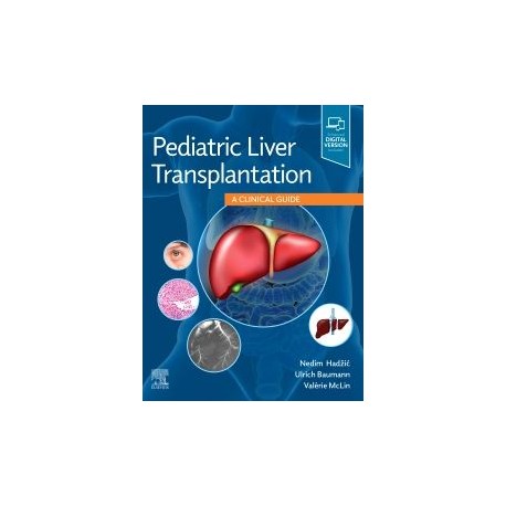 Pediatric Liver Transplantation