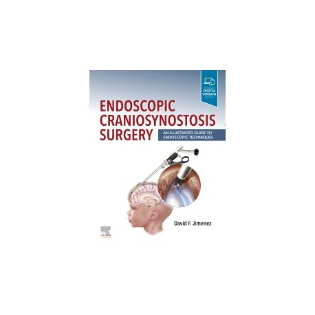 Endoscopic Craniosynostosis Surgery