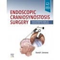 Endoscopic Craniosynostosis Surgery