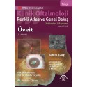 Klinik Oftalmoloji Renkli Atlas ve Genel Bakış - ÜVEİT