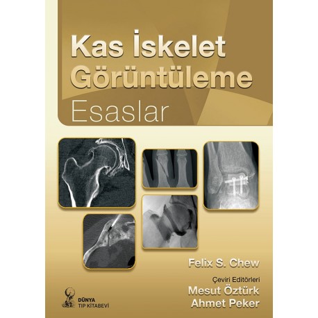 Kas İskelet Görüntüleme: Esaslar