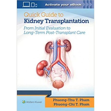 Quick Guide to Kidney Transplantation