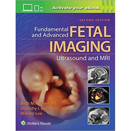 Fundamental and Advanced Fetal Imaging Ultrasound and MRI