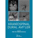 Kraniospinal Dural AVF’ler