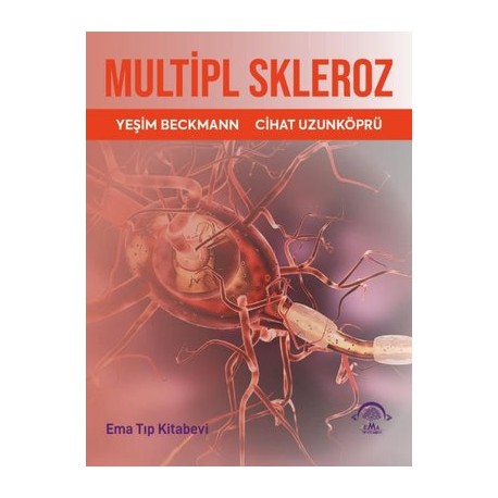 Multipl Skleroz