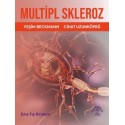 Multipl Skleroz