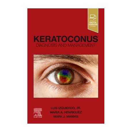 Keratoconus Diagnosis and Management