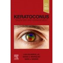 Keratoconus Diagnosis and Management