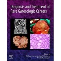 Diagnosis and Treatment of Rare Gynecologic Cancers