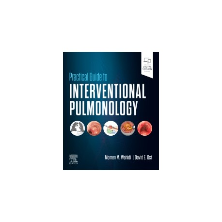 Practical Guide to Interventional Pulmonology