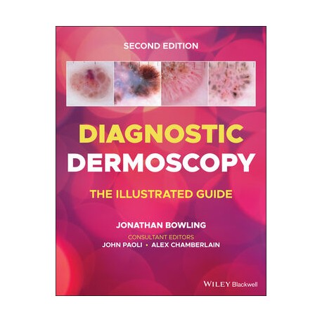 Diagnostic Dermoscopy: The Illustrated Guide, 2nd Edition