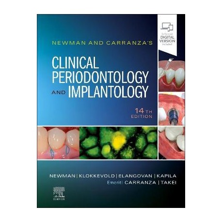 Newman and Carranza's Clinical Periodontology and Implantology, 14th Edition