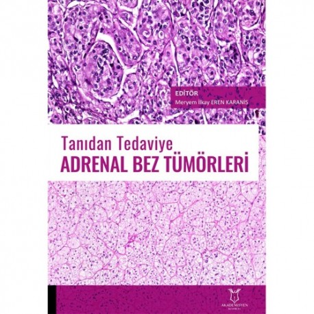 Tanıdan Tedaviye Adrenal Bez Tümörleri