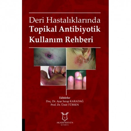 Deri Hastalıklarında Topikal Antibiyotik Kullanım Rehberi