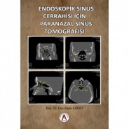 Endoskopik Sinüs Cerrahisi İçin Paranazal Sinüs Tomografisi