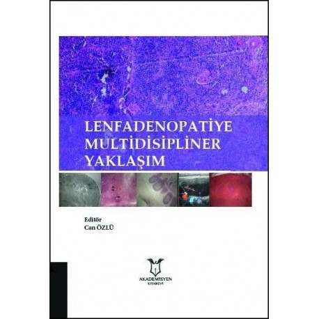 Lenfadenopatiye Multidisipliner Yaklaşım