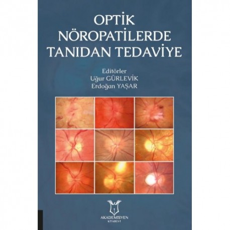 Optik Nöropatilerde Tanıdan Tedaviye