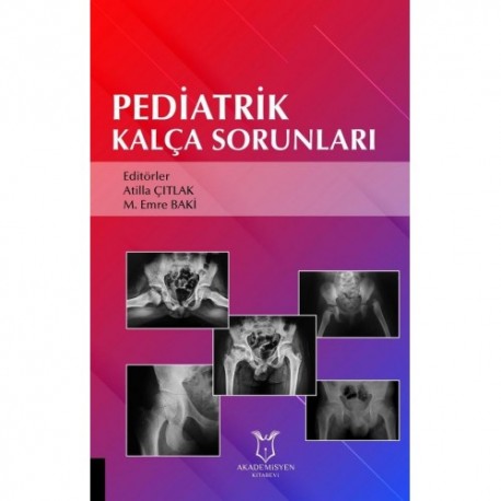 Pediatrik Kalça Sorunları