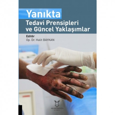 Yanıkta Tedavi Prensipleri ve Güncel Yaklaşımlar