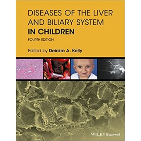 Diseases of the Liver and Biliary System in Children, 4th Edition