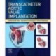 Transcatheter Aortic Valve Implantation